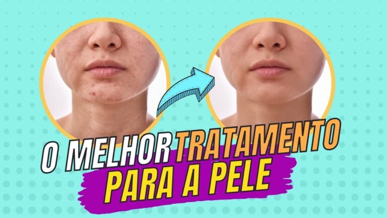 O melhor tratamento para a pele